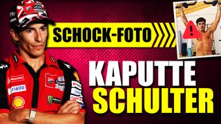 Marc Marquez zeigt kaputte Schulter: Warum gerade jetzt? Marc Marquez zeigt kaputte Schulter: Warum gerade jetzt?