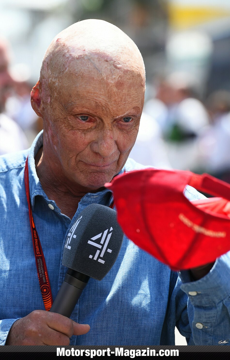 Niki Lauda Ohne Kappe Niki Lauda Ohne Kappe